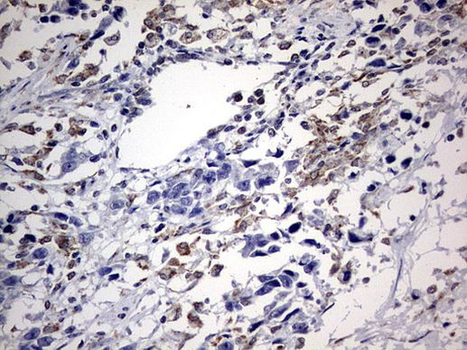 ABCD1 Antibody in Immunohistochemistry (Paraffin) (IHC (P))