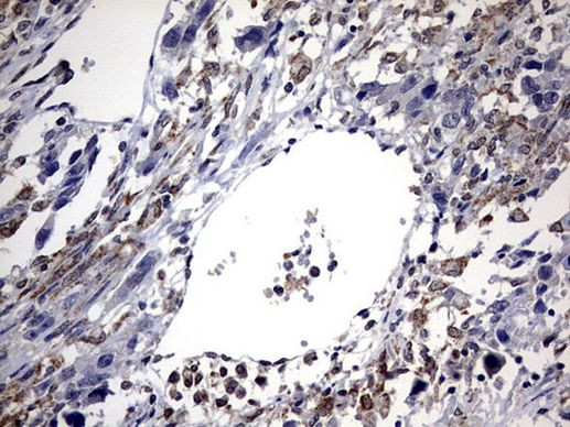 ABCD1 Antibody in Immunohistochemistry (Paraffin) (IHC (P))