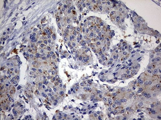 ABCD1 Antibody in Immunohistochemistry (Paraffin) (IHC (P))