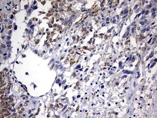 ABCD1 Antibody in Immunohistochemistry (Paraffin) (IHC (P))