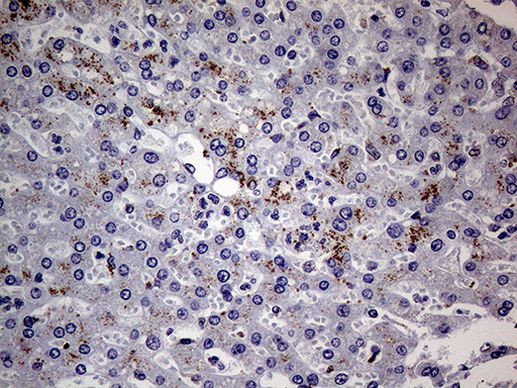 ABCD1 Antibody in Immunohistochemistry (Paraffin) (IHC (P))