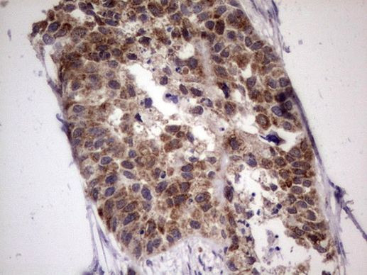 ABCD1 Antibody in Immunohistochemistry (Paraffin) (IHC (P))