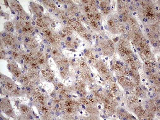 ABCD1 Antibody in Immunohistochemistry (Paraffin) (IHC (P))