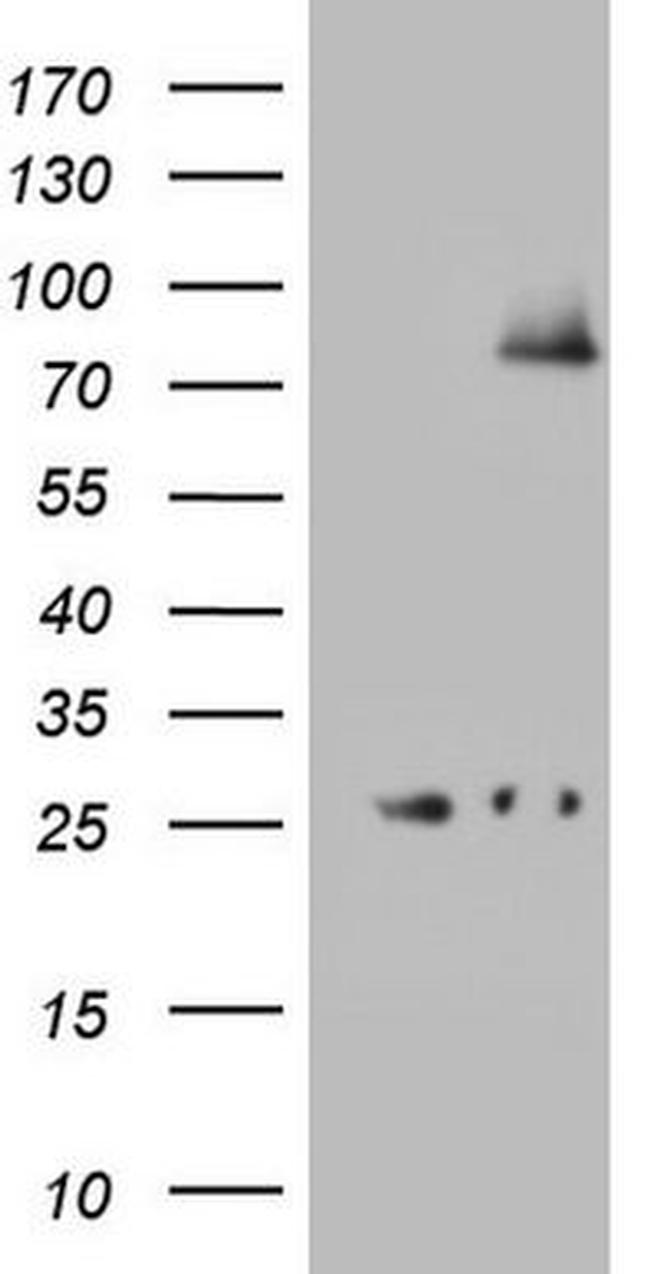 ABCD1 Antibody in Western Blot (WB)