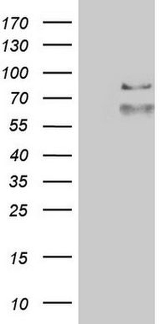 ABCD1 Antibody in Western Blot (WB)