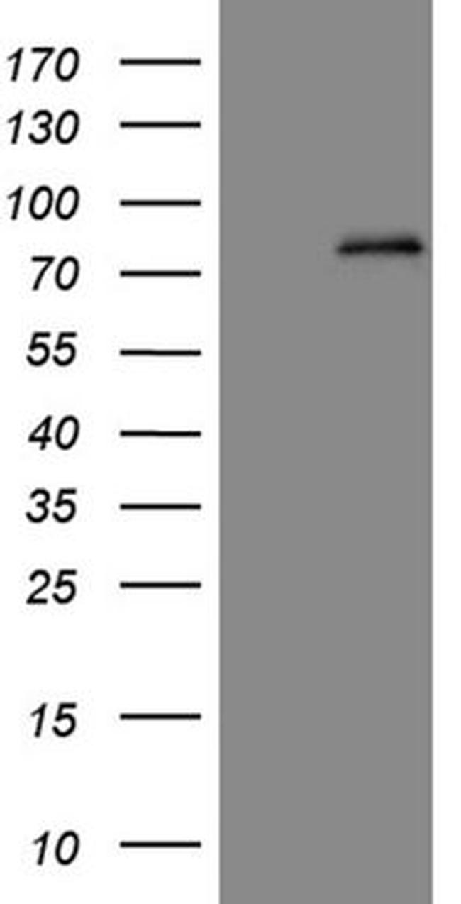 ABCD1 Antibody in Western Blot (WB)