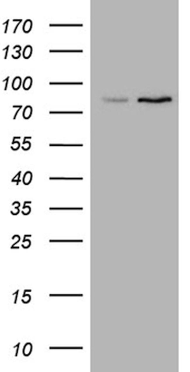 ABCD2 Antibody in Western Blot (WB)