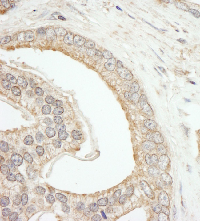 ABCF2 Antibody in Immunohistochemistry (IHC)