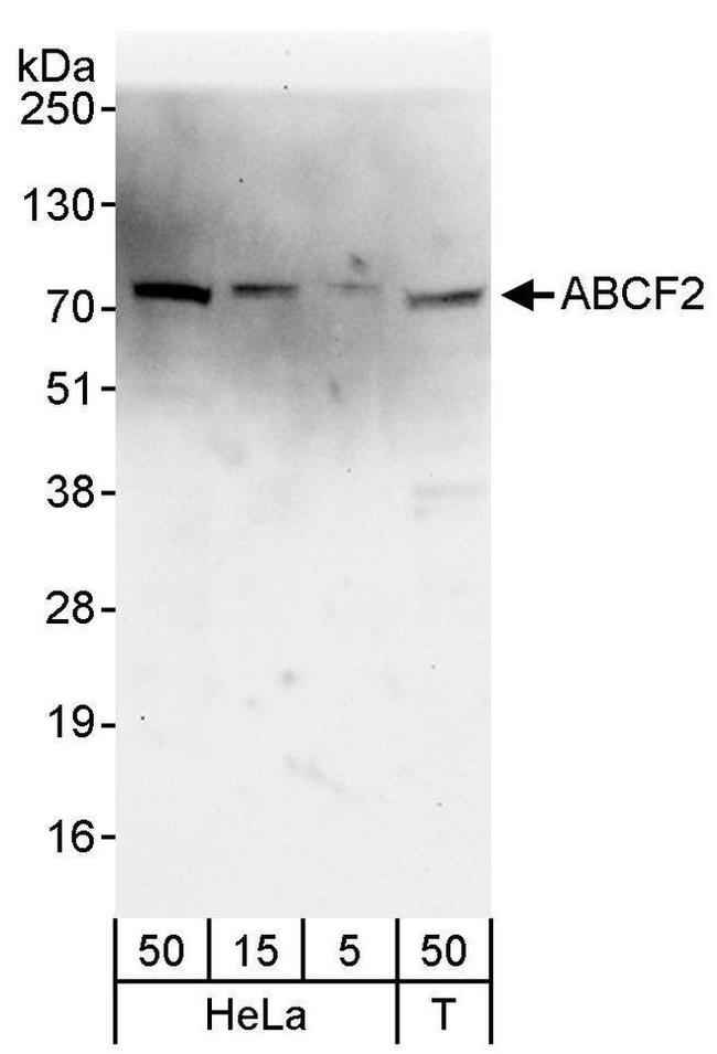 ABCF2 Antibody in Western Blot (WB)