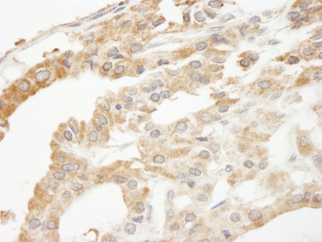 ABCF2 Antibody in Immunohistochemistry (IHC)