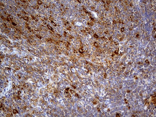 ABCF2 Antibody in Immunohistochemistry (Paraffin) (IHC (P))