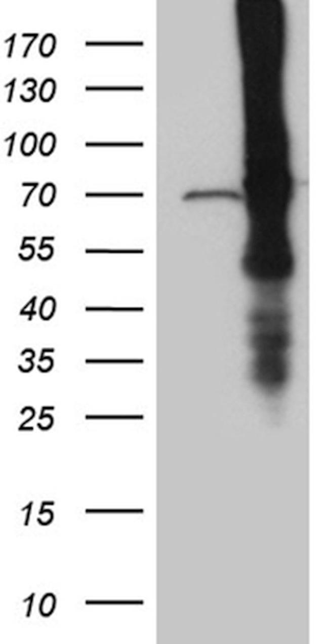 ABCF2 Antibody in Western Blot (WB)