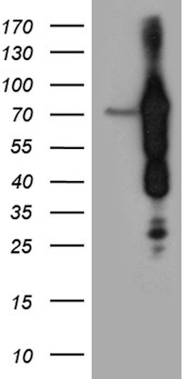 ABCF2 Antibody in Western Blot (WB)