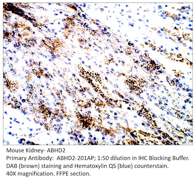 ABHD2 Antibody in Immunohistochemistry (IHC)