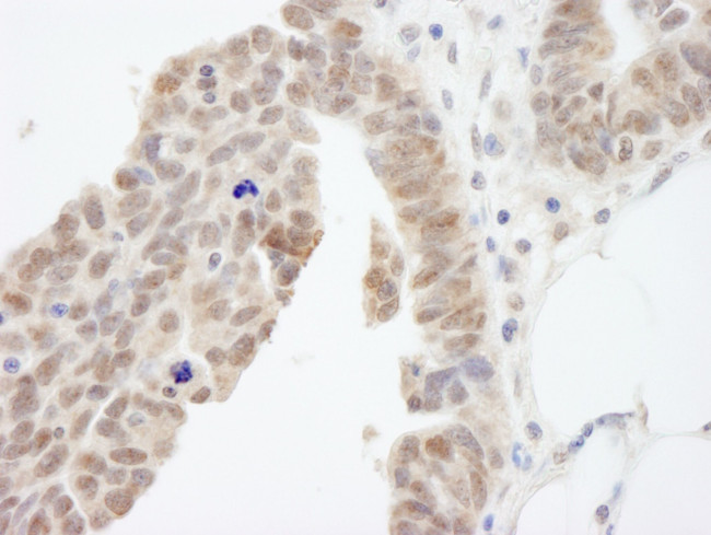 ABI1 Antibody in Immunohistochemistry (IHC)