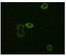 Abl2 Antibody in Immunocytochemistry (ICC/IF)