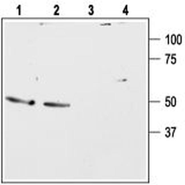 Bombesin Receptor 2 (GRPR) (extracellular) Antibody in Western Blot (WB)