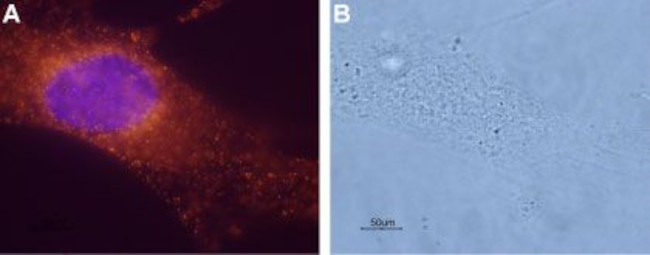 Bombesin Receptor 1 (NMBR) Antibody in Immunocytochemistry (ICC/IF)