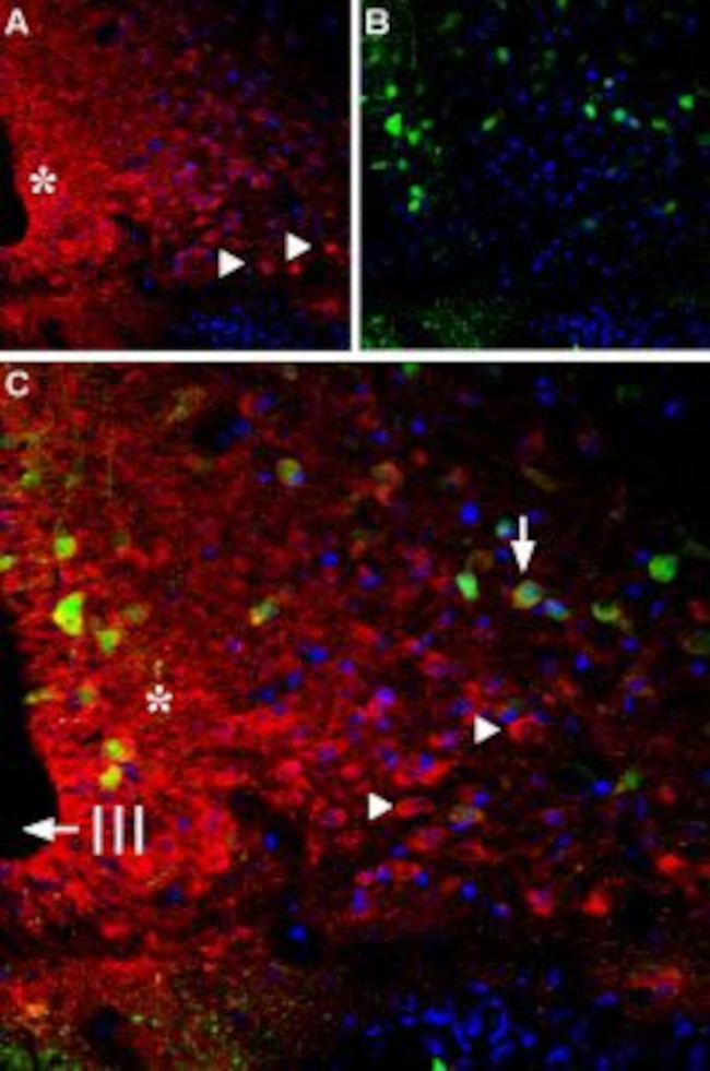 Bombesin Receptor 1 (NMBR) Antibody in Immunohistochemistry (Frozen) (IHC (F))