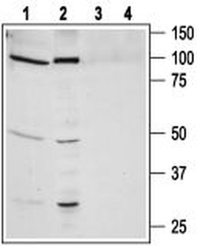 Bombesin Receptor 1 (NMBR) Antibody in Western Blot (WB)