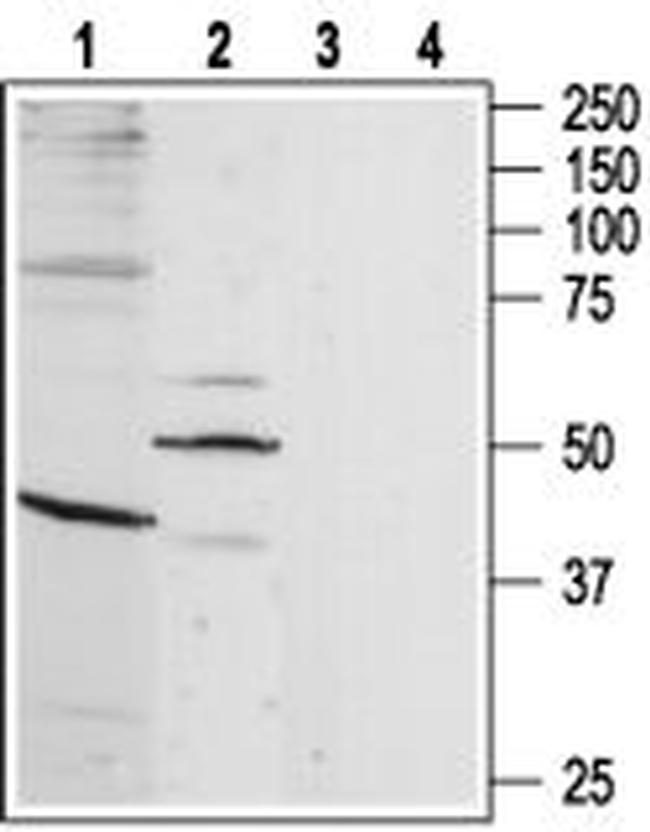 B1 Bradykinin Receptor (BDKRB1) Antibody in Western Blot (WB)