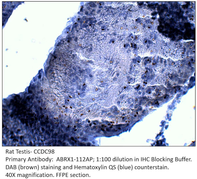 CCDC98 Antibody in Immunohistochemistry (IHC)