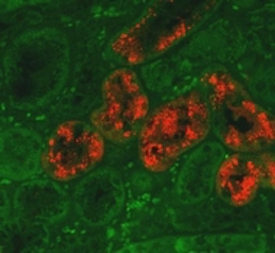 NGAL Antibody in Immunohistochemistry (Paraffin) (IHC (P))