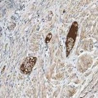 APC-AAT complexes Antibody in Immunohistochemistry (IHC)