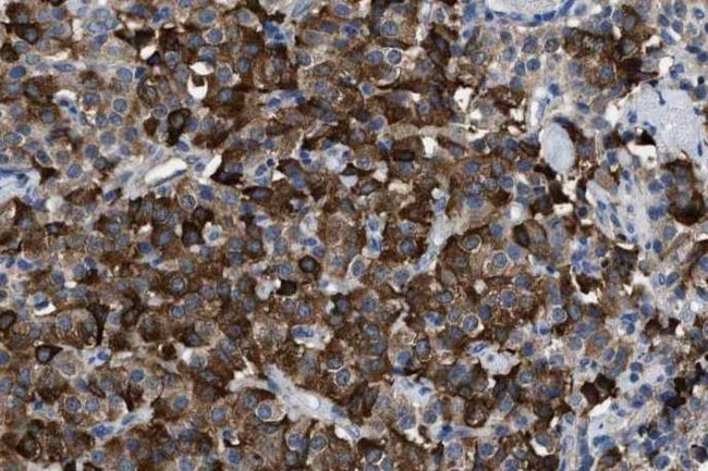 Leptin Antibody in Immunohistochemistry (IHC)