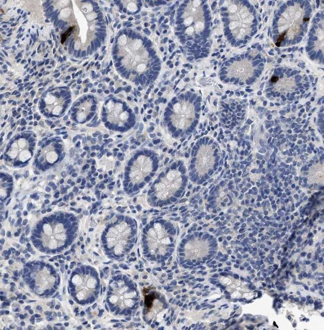 PYY Antibody in Immunohistochemistry (Paraffin) (IHC (P))