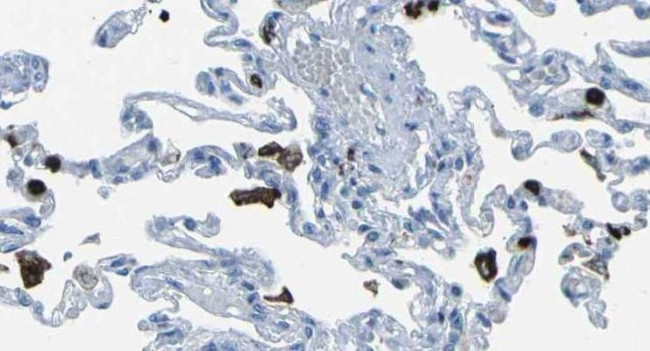 FCN1 Antibody in Immunohistochemistry (IHC)