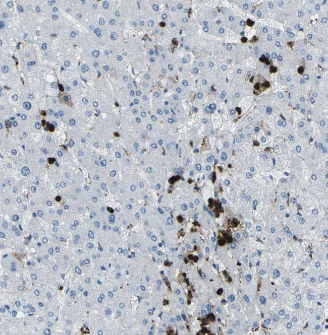 FCN1 Antibody in Immunohistochemistry (IHC)