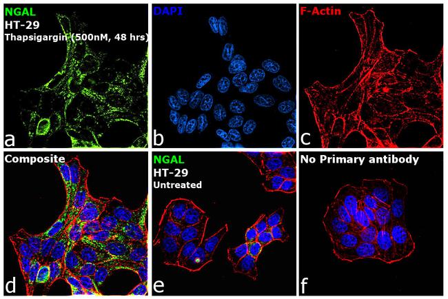 NGAL Antibody