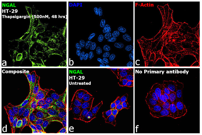 NGAL Antibody in Immunocytochemistry (ICC/IF)