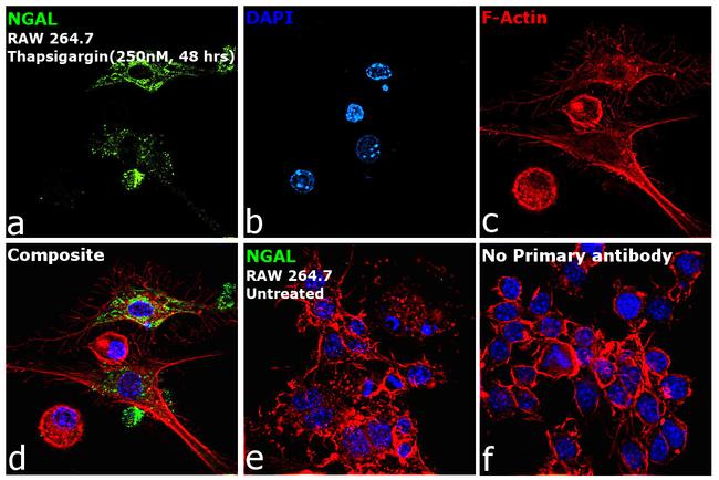 NGAL Antibody