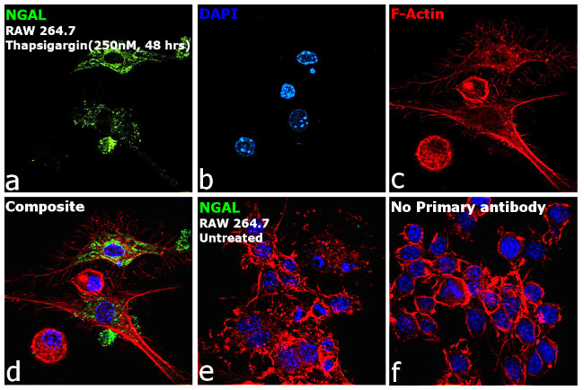 NGAL Antibody in Immunocytochemistry (ICC/IF)