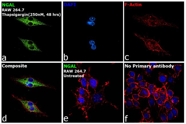 NGAL Antibody