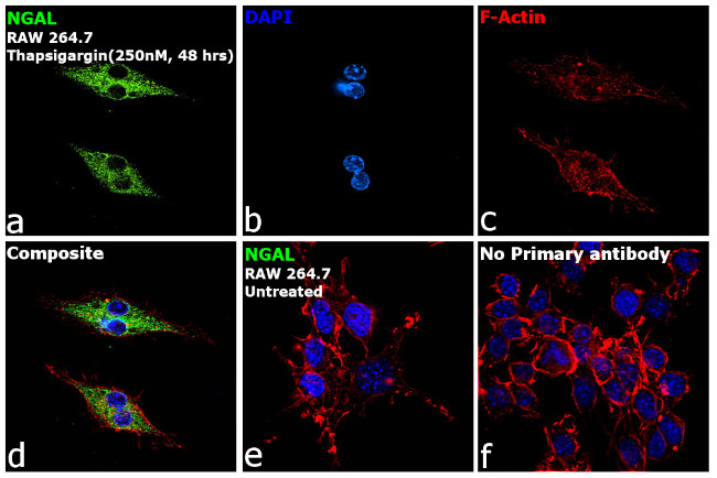 NGAL Antibody in Immunocytochemistry (ICC/IF)