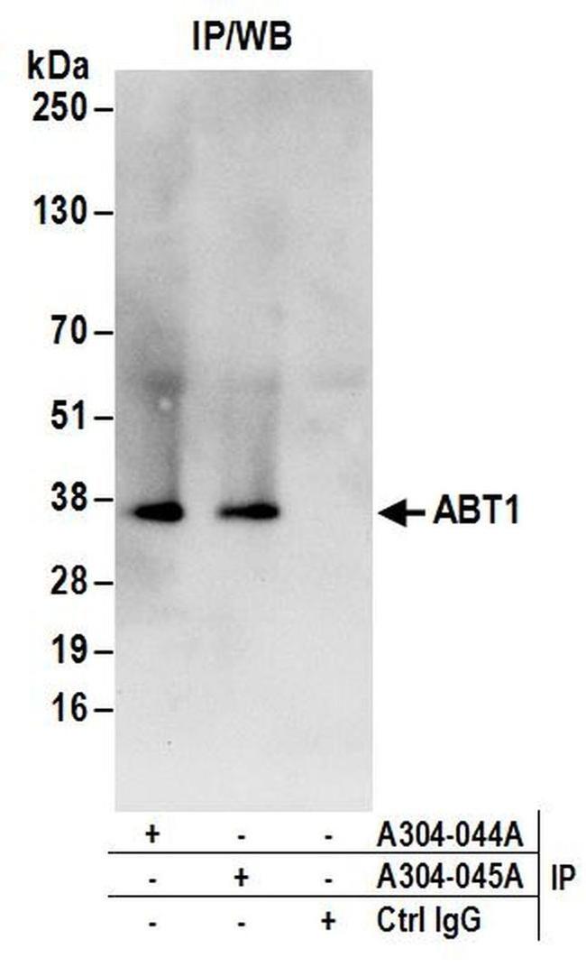 ABT1 Antibody in Western Blot (WB)