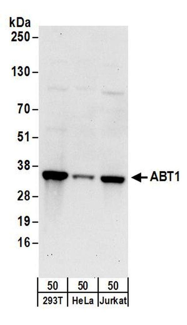 ABT1 Antibody in Western Blot (WB)