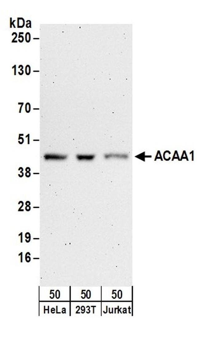 ACAA1 Antibody in Western Blot (WB)