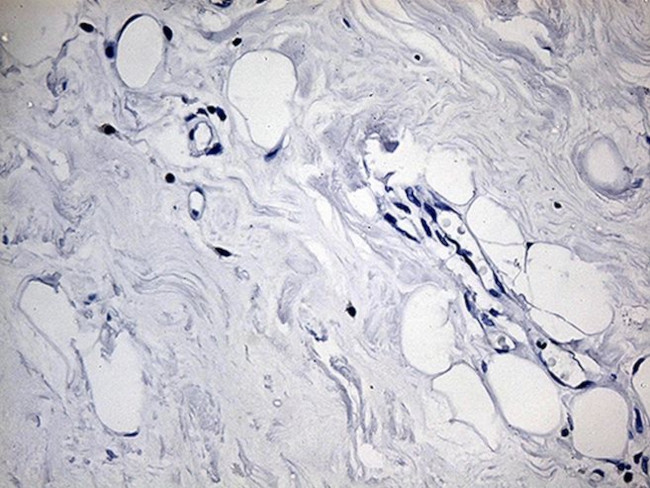 ACAA1 Antibody in Immunohistochemistry (Paraffin) (IHC (P))