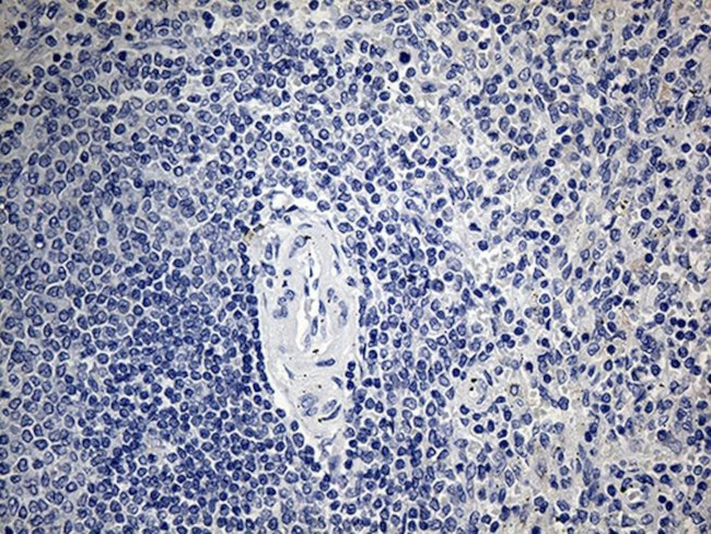 ACAA1 Antibody in Immunohistochemistry (Paraffin) (IHC (P))