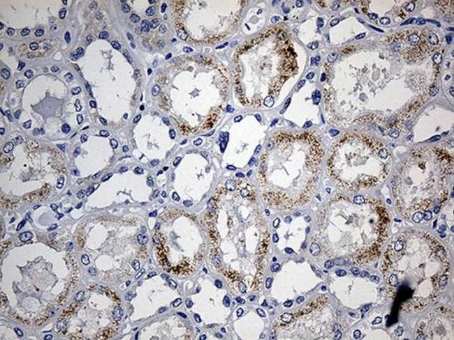 ACAA1 Antibody in Immunohistochemistry (Paraffin) (IHC (P))