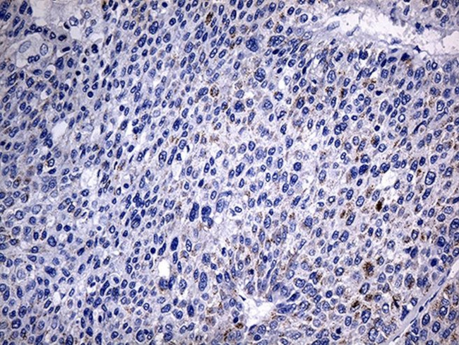 ACAA1 Antibody in Immunohistochemistry (Paraffin) (IHC (P))