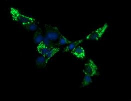 ACAA2 Antibody in Immunocytochemistry (ICC/IF)