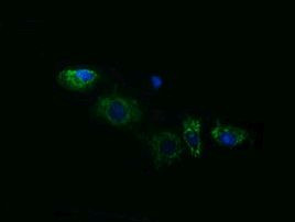 ACAA2 Antibody in Immunocytochemistry (ICC/IF)