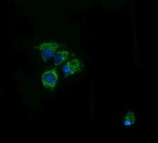 ACAA2 Antibody in Immunocytochemistry (ICC/IF)