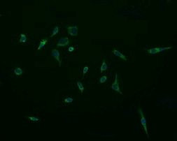 ACAA2 Antibody in Immunocytochemistry (ICC/IF)