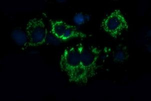 ACAA2 Antibody in Immunocytochemistry (ICC/IF)